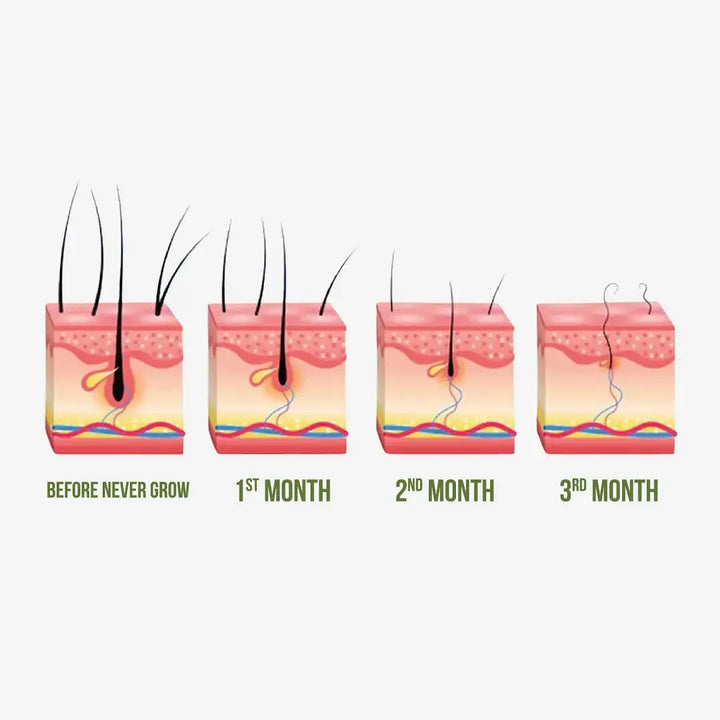 ✨ Never Grow Hair Serum. | Buy 1 Get 1 FREE