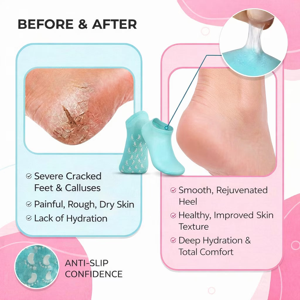 Healing Therapy Gel Socks✨ | Buy One Get One Free 🔥| Adjustable Size